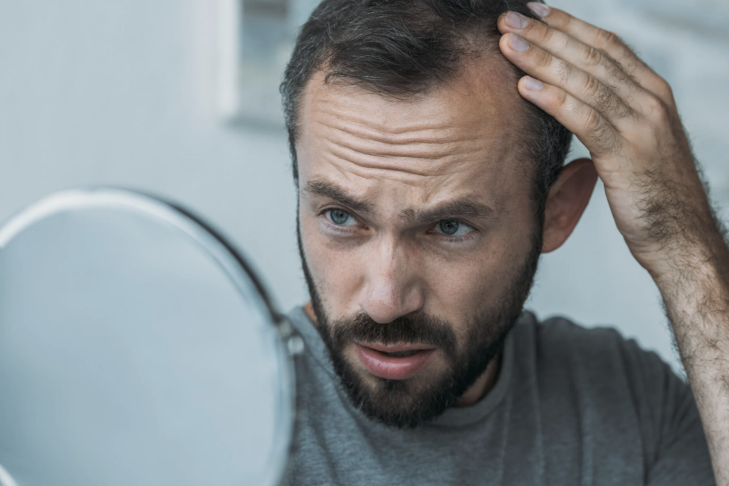 Comprendre les causes et solutions à la perte de cheveux : guide complet pour préserver sa chevelure